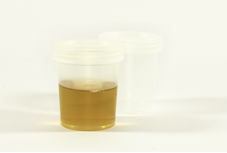 How To Measure Proper Hydration For Athletes With Urine